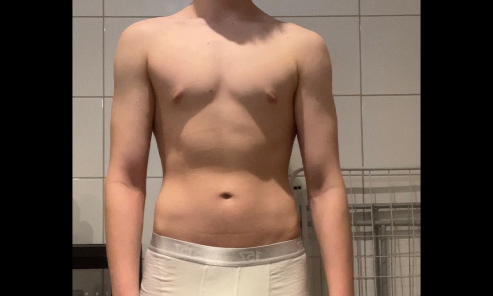 After Transformation 2