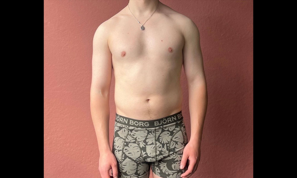 Before Transformation 1