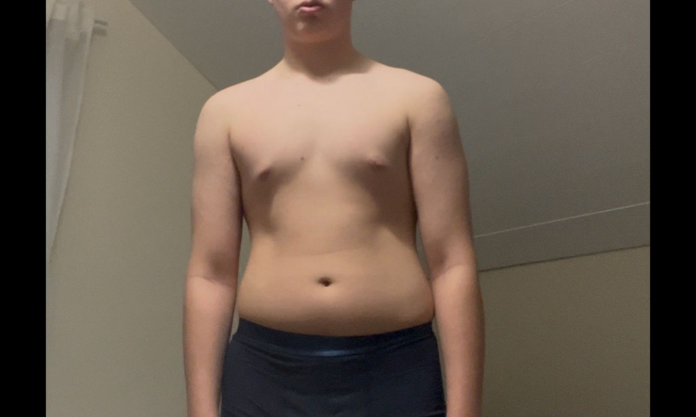 Before Transformation 2