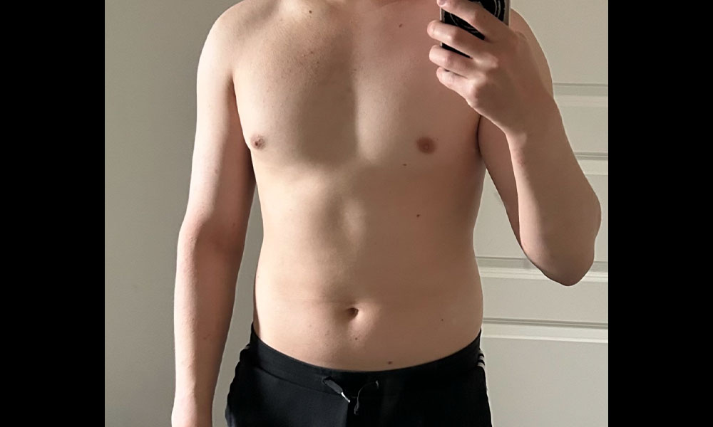 Before Transformation 3
